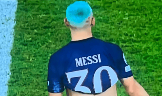 المشكلة الحقيقية التي يواجهها كريم بنزيما مع ريال مدريد 